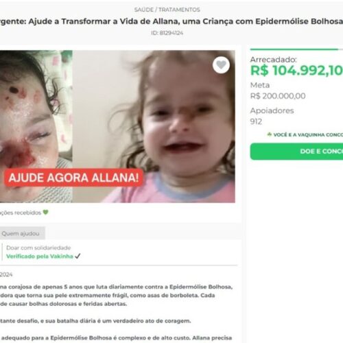 Polícia investiga suspeitos de usarem fotos de criança com doença rara para arrecadar dinheiro