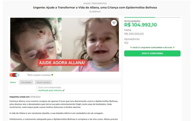 Polícia investiga suspeitos de usarem fotos de criança com doença rara para arrecadar dinheiro