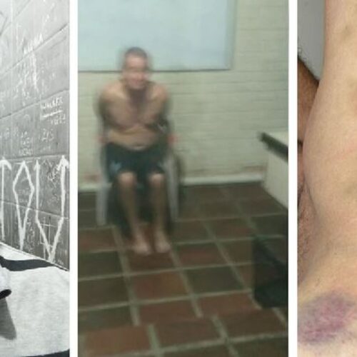 Polícia e Conselho de Enfermagem investigam se donos de clínica em SP, que são enfermeiros, também torturaram paciente até a morte
